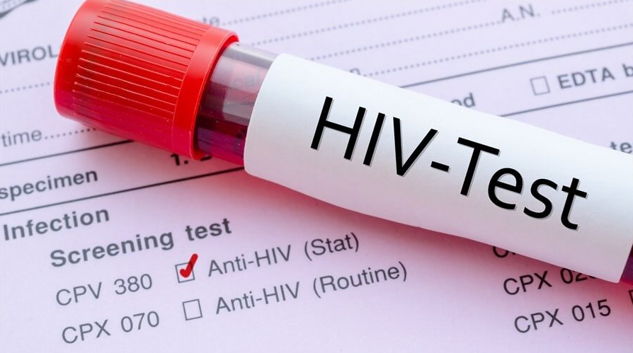 HIV Testi / HIV RNA Testi / HIV PCR Testi