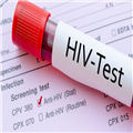 HIV Testi / HIV RNA Testi / HIV PCR Testi