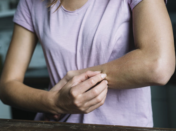 Moleküler Alerji Testi Alex II Alerji Testi Çocuk Alerji Testi